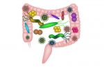 کشف باکتری‌هایی که در ابتلا به سرطان روده دست دارند