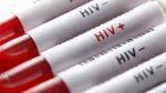 وزیر بهداشت: سرنگ آلوده عامل شیوع HIV در لردگان نیست
 2